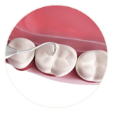 illustration of teeth being cleaned with scrapping tool